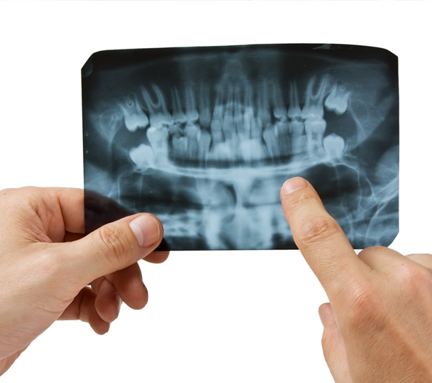 North Richland Hills 7 Signs You Need Endodontic Surgery