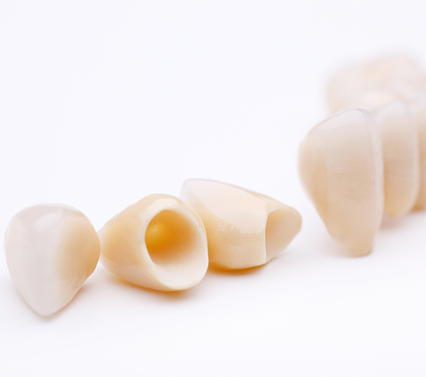 North Richland Hills Dental Crowns and Dental Bridges