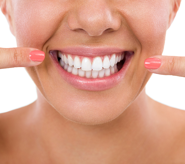 North Richland Hills What Is Gum Contouring and Reshaping