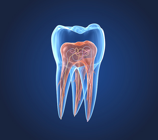 North Richland Hills What is an Endodontist